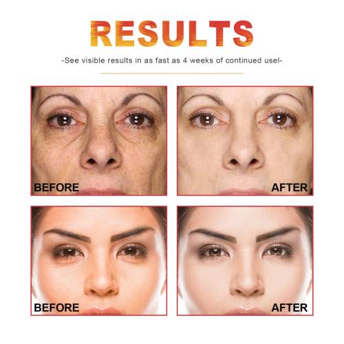 Vitamin C, Retinol & Hyaluronsäure Gesichtsserum