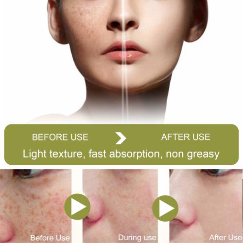 Niacinamid & Vitamin C Glow Creme