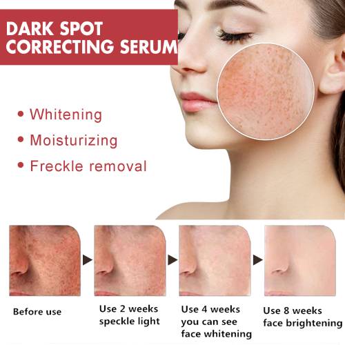 Serum gegen dunkle Flecken mit Niacinamid
