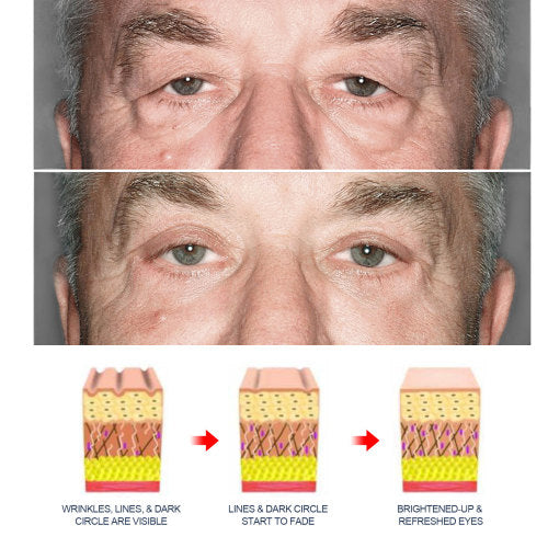 Retinol Augencreme für Männer