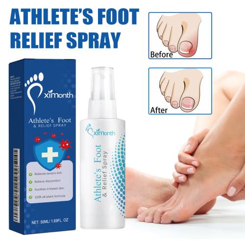 Allantoin fodplejespray