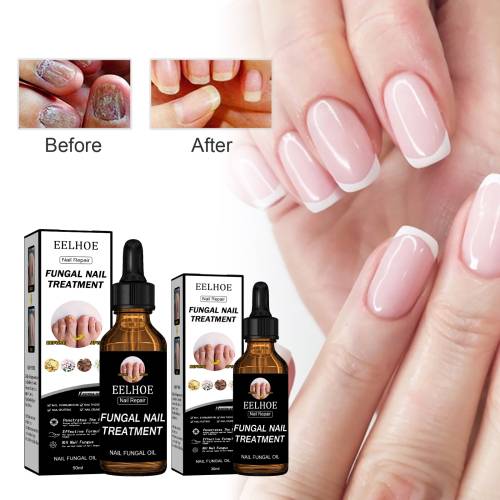Nagelpflege-Lösung mit Panthenol