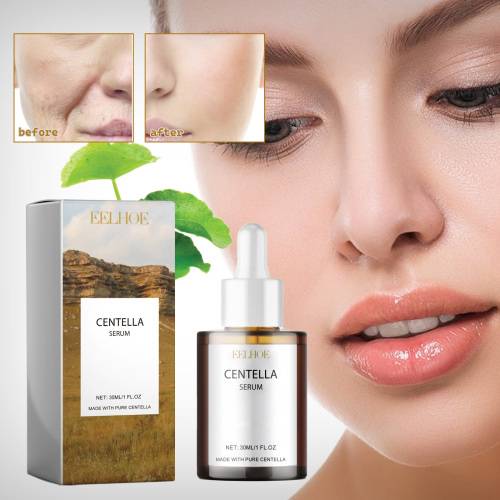 Centella Serum mit Hyaluronsäure