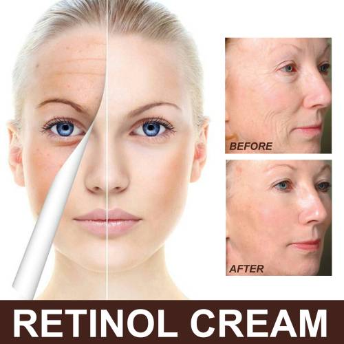 Retinol Gesichtscreme, straffend und aufhellend