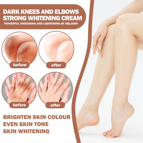 Creme für Ellbogen und Knie mit Glutathion und Kojisäure