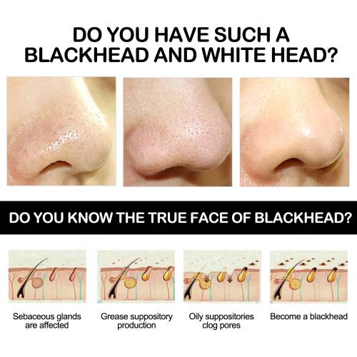 Bambuskohle Peel-Off Maske gegen Mitesser