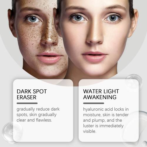 Vitamin C Gesichtslotion gegen Pigmentflecken