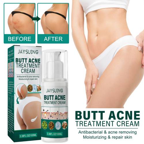 Po-Creme mit Sheabutter, klärend
