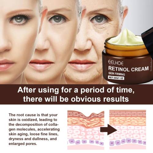 Retinol Gesichtscreme, straffend und aufhellend