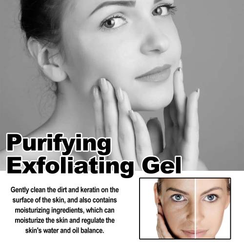 Salicylsäure Peeling-Gel, porenverfeinernd