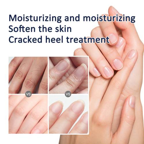 Sheabutter Hand- und Fußcreme für rissige Haut