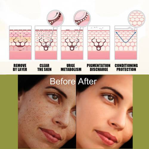 Niacinamid & Vitamin C Glow Creme