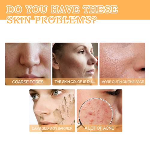 Glykolsäure 7% Toner, klärend