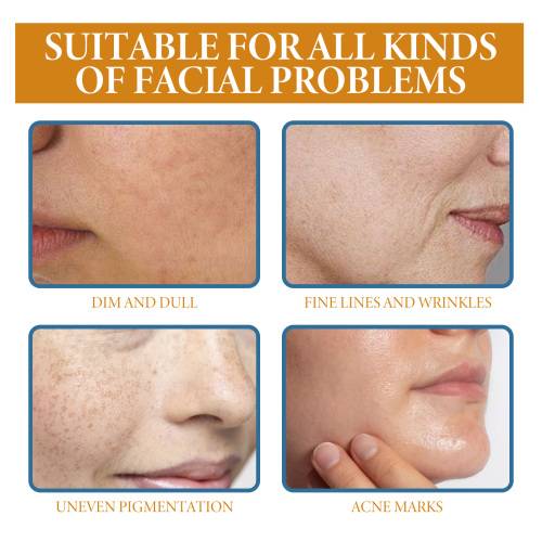 Retinol Gesichtsserum für ein ebenmäßigeres Hautbild