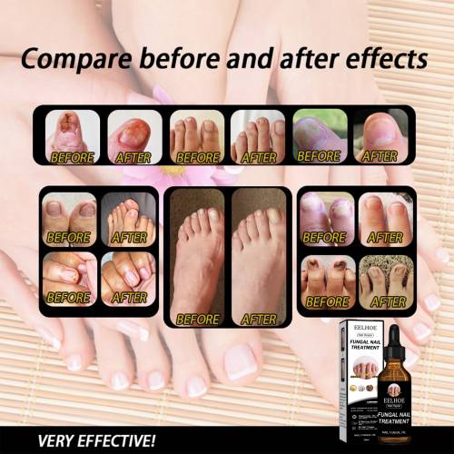 Nagelpflege-Lösung mit Panthenol