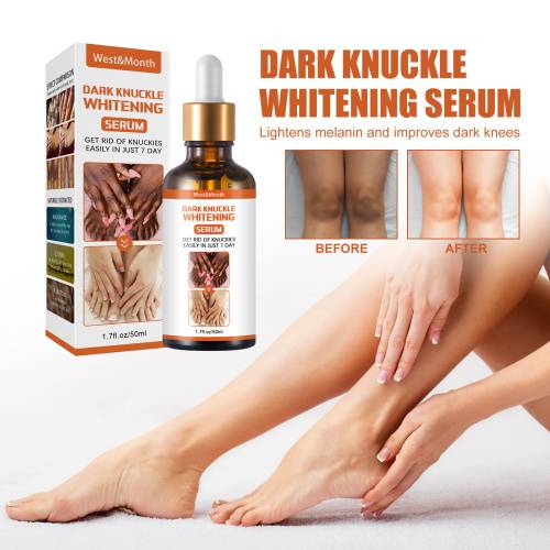 Aufhellendes Serum für Knie, Ellbogen und Knöchel, 50 g