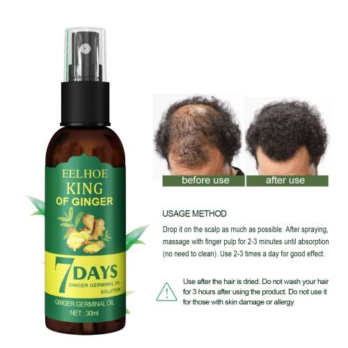 Ingwer Kopfhautspray, 30 ml