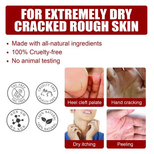 Peeling-Fußmaske mit Salicyl- und Apfelsäure