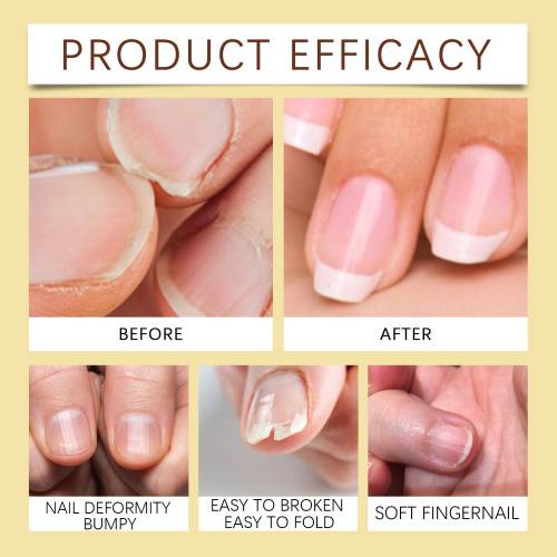 Jojoba Nagelhautöl mit Vitamin C und E