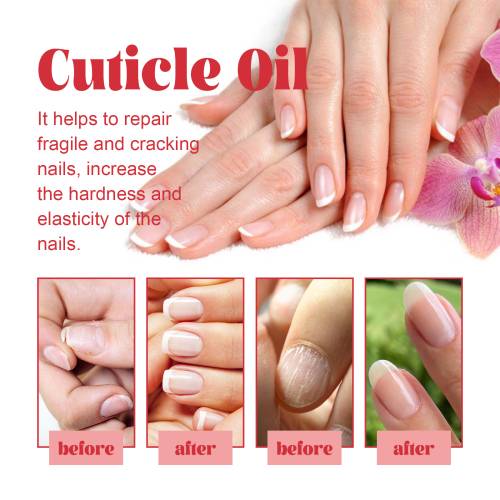 Nagelhautöl mit Pfirsich, Jojoba und Kamelie