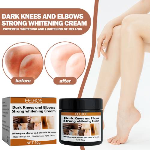 Creme für Ellbogen und Knie mit Glutathion und Kojisäure